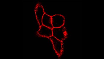 Un nuevo estudio revela que la enzima PADI3 contribuye a la resistencia al tratamiento con neratinib en el cáncer de mama HER2 positivo