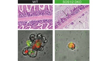 Investigadores del CIC identifican SOS1 y SOS2 como proteínas clave para la integridad intestinal